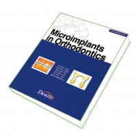 Book on Microimplants in Orthodontics